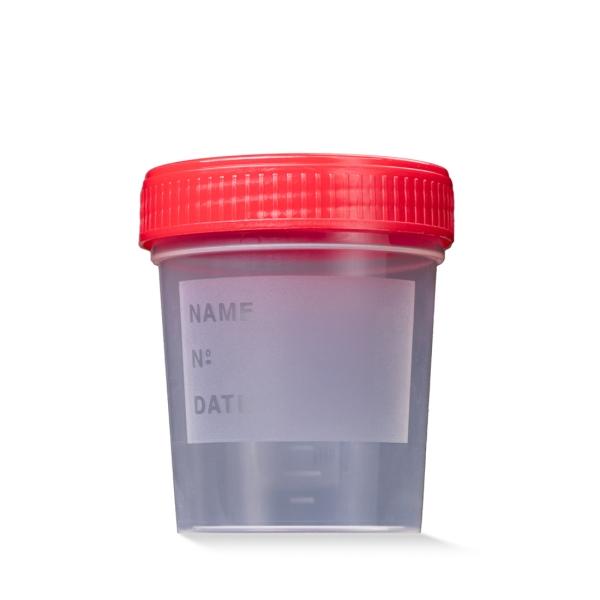 AMPri Universalbecher mit Schraubverschluss 125 ml, steril, rot 1 Karton = 200 Stück