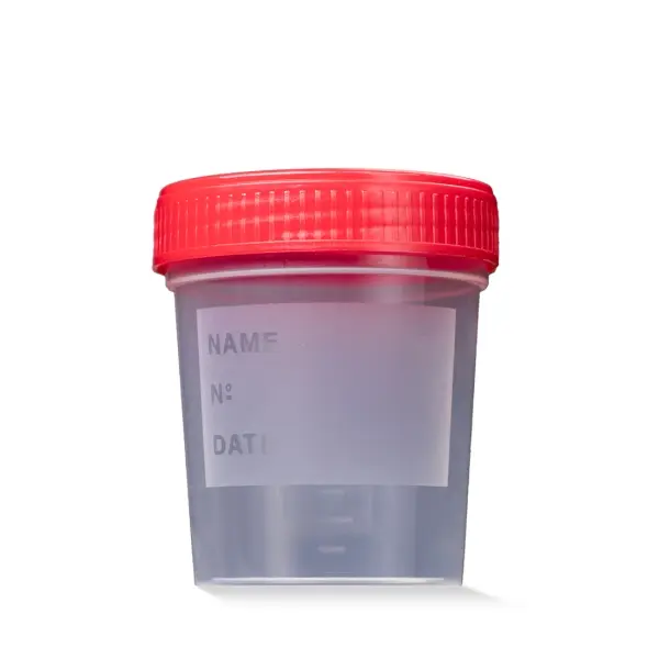 AMPri Universalbecher mit Schraubverschluss 125 ml, steril, rot 1 Karton = 200 Stück